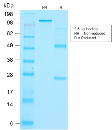 Thyroglobulin (Thyroidal Cell Marker) Antibody in SDS-PAGE (SDS-PAGE)