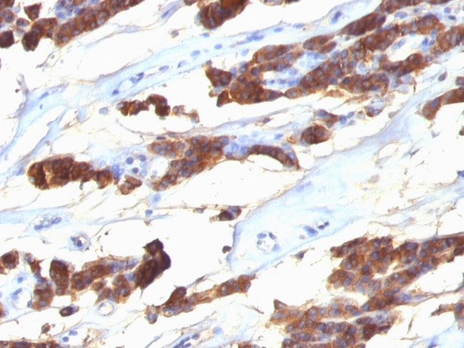 Thyroglobulin (Thyroidal Cell Marker) Antibody in Immunohistochemistry (Paraffin) (IHC (P))