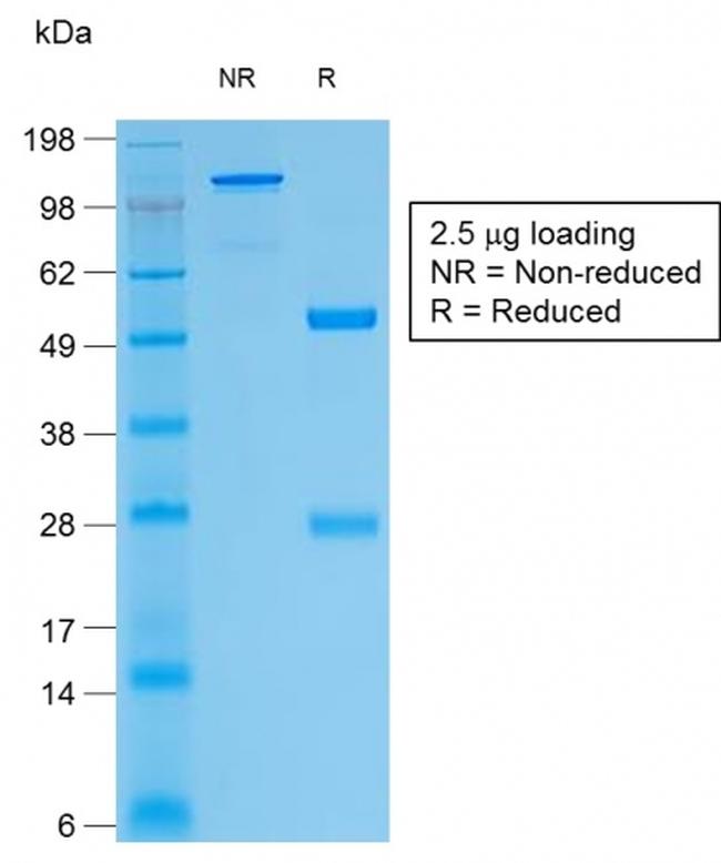 Thyroglobulin Antibody in SDS-PAGE (SDS-PAGE)