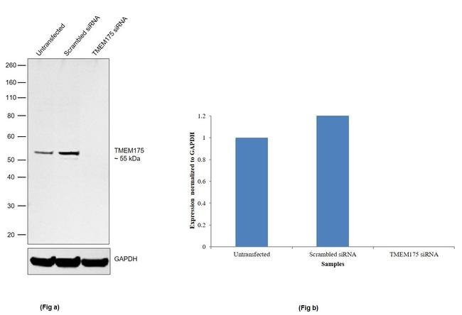 TMEM175 Antibody in Western Blot (WB)