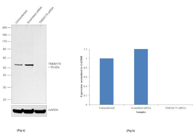 TMEM175 Antibody