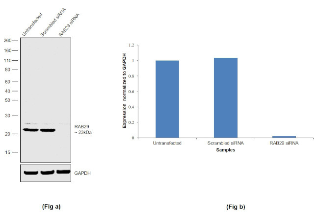 RAB29 Antibody