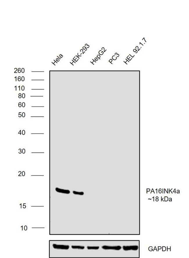 p16INK4a Antibody in Western Blot (WB)