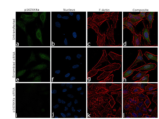 p16INK4a Antibody in Immunocytochemistry (ICC/IF)