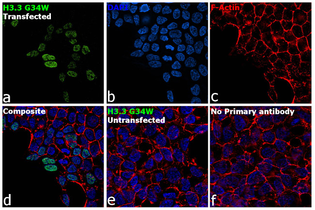 H3.3 G34W oncohistone mutant Antibody in Immunocytochemistry (ICC/IF)