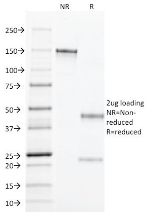 TGF-alpha (Transforming Growth Factor alpha) Antibody in SDS-PAGE (SDS-PAGE)