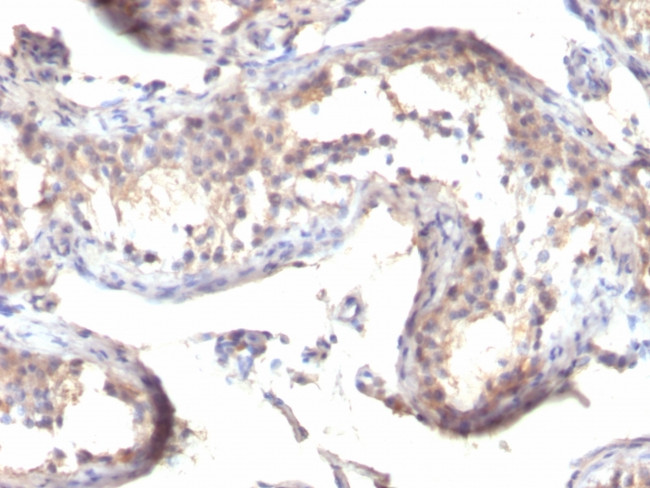 TGF-alpha (Transforming Growth Factor alpha) Antibody in Immunohistochemistry (Paraffin) (IHC (P))