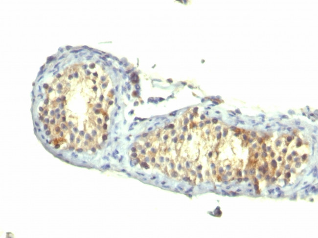 TGF-alpha (Transforming Growth Factor alpha) Antibody in Immunohistochemistry (Paraffin) (IHC (P))