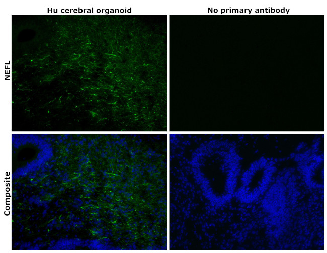 NEFL Antibody in Immunohistochemistry (Paraffin) (IHC (P))