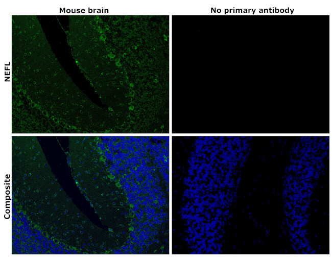 NEFL Antibody in Immunohistochemistry (Paraffin) (IHC (P))