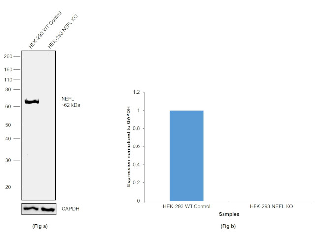 NEFL Antibody in Western Blot (WB)