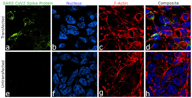 SARS-CoV-2 Spike Protein (RBD) Antibody in Immunocytochemistry (ICC/IF)