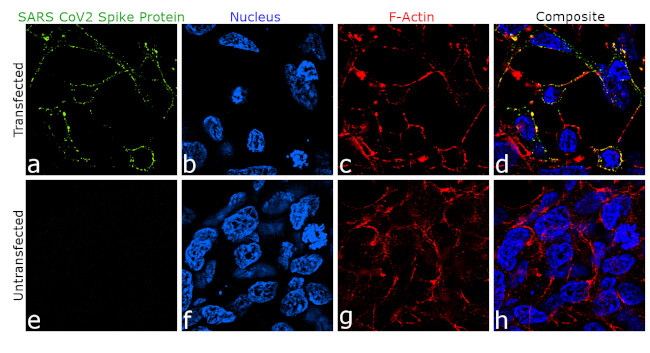 SARS-CoV-2 Spike Protein (RBD) Chimeric Antibody in Immunocytochemistry (ICC/IF)