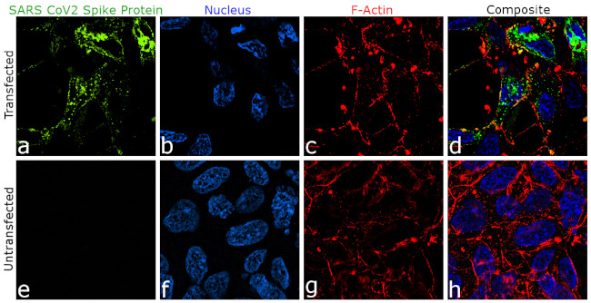 SARS-CoV-2 Spike Protein (RBD) Antibody in Immunocytochemistry (ICC/IF)