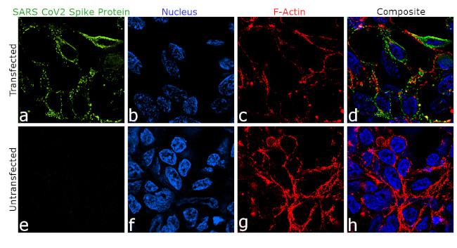 SARS-CoV-2 Spike Protein (RBD) Chimeric Antibody in Immunocytochemistry (ICC/IF)