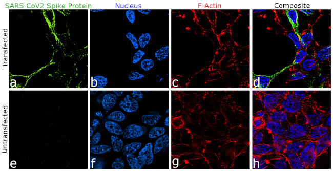 SARS-CoV-2 Spike Protein (RBD) Antibody in Immunocytochemistry (ICC/IF)