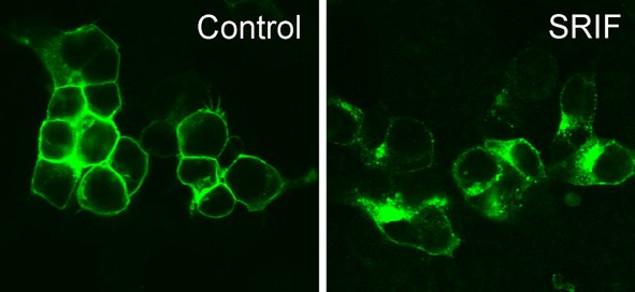 SSTR3 Antibody in Immunocytochemistry (ICC/IF)