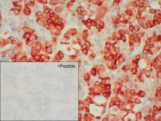 SSTR3 Antibody in Immunohistochemistry (IHC)