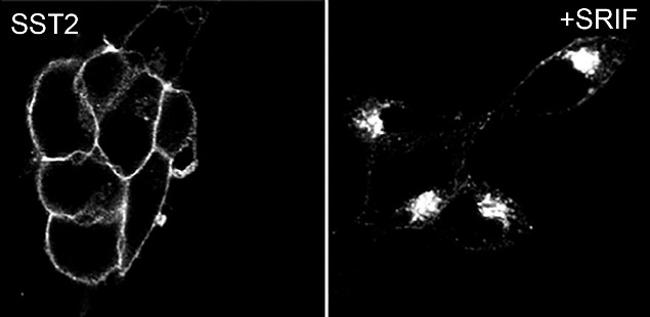 SSTR2 Antibody