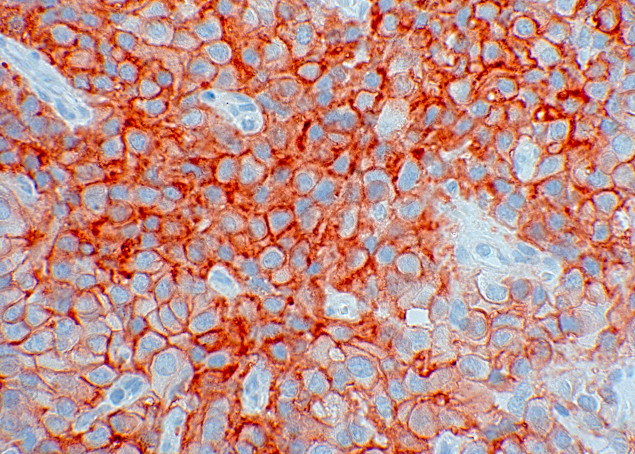 SSTR2 Antibody in Immunohistochemistry (IHC)