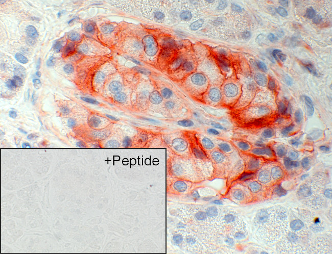 SSTR5 Antibody in Immunohistochemistry (IHC)