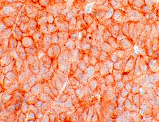 SSTR5 Antibody in Immunohistochemistry (IHC)