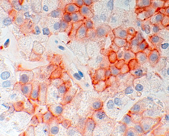 SSTR5 Antibody in Immunohistochemistry (IHC)