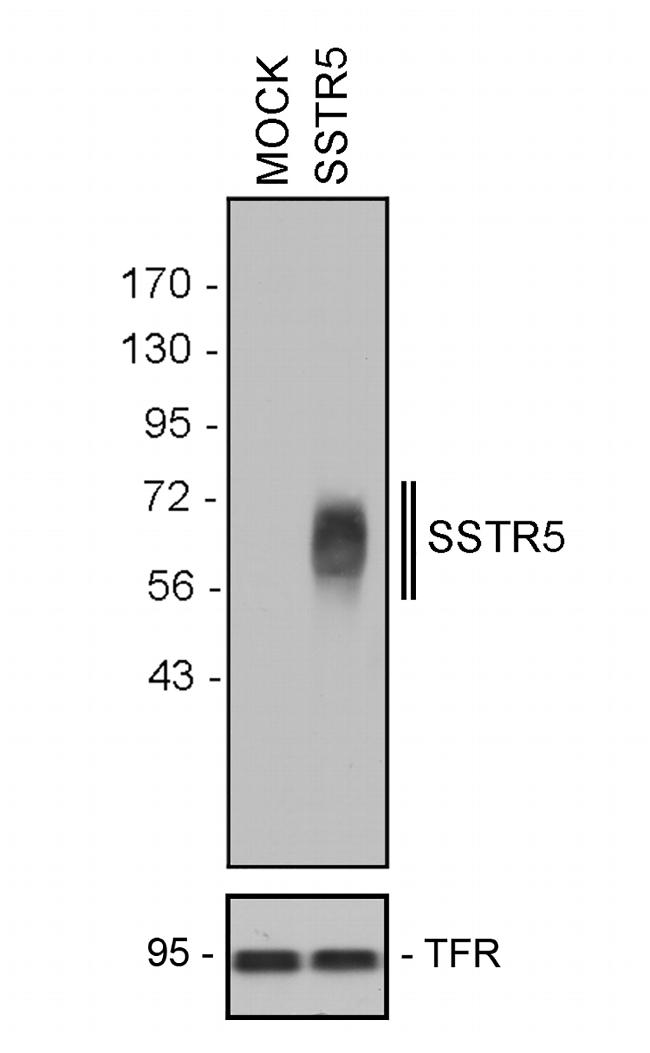 SSTR5 Antibody in Western Blot (WB)