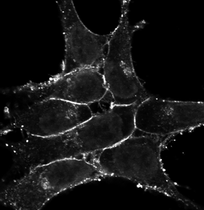 CXCR4 Antibody in Immunocytochemistry (ICC/IF)