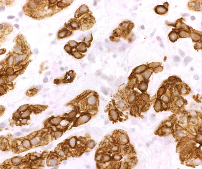 CXCR4 Antibody in Immunohistochemistry (IHC)