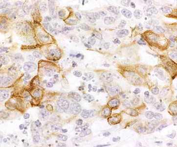 CXCR4 Antibody in Immunohistochemistry (IHC)