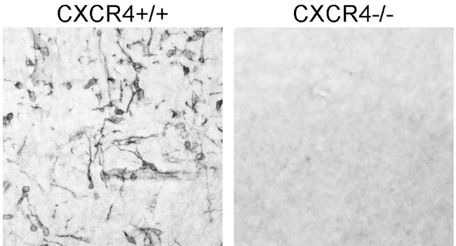 CXCR4 Antibody in Immunohistochemistry (IHC)