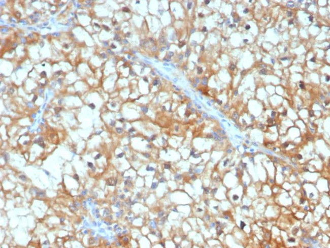 TGFB3/PEIG-1/RAI3/RAIG1/TIG1 Antibody in Immunohistochemistry (Paraffin) (IHC (P))