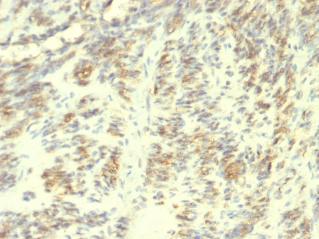 Transglutaminase II (TGM2) Antibody in Immunohistochemistry (Paraffin) (IHC (P))