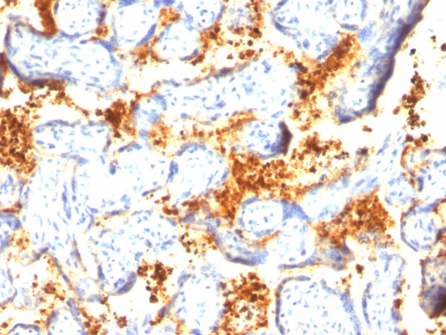 Transglutaminase II (TGM2) Antibody in Immunohistochemistry (Paraffin) (IHC (P))