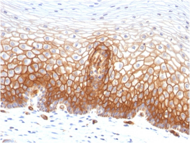 Thrombomodulin/CD141 Antibody in Immunohistochemistry (Paraffin) (IHC (P))