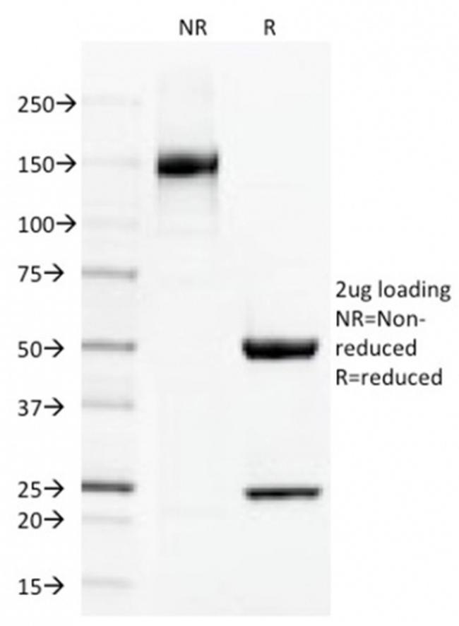 Thrombomodulin/CD141 Antibody in SDS-PAGE (SDS-PAGE)