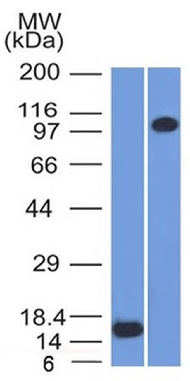 Thrombomodulin/CD141 Antibody in Western Blot (WB)