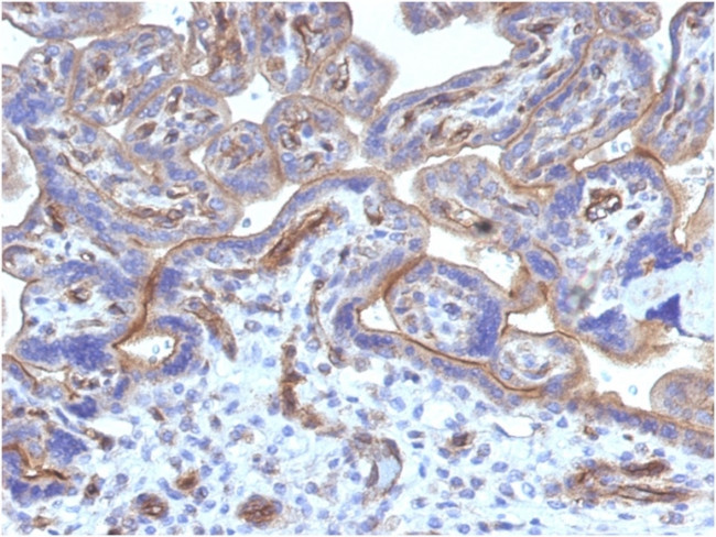 Thrombomodulin/CD141 Antibody in Immunohistochemistry (Paraffin) (IHC (P))