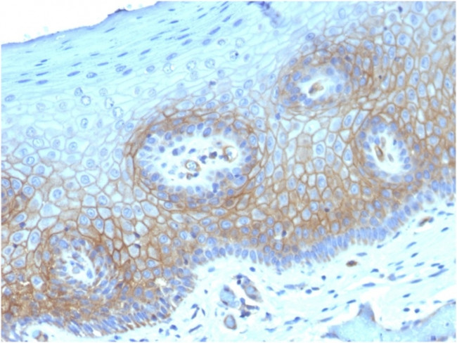 Thrombomodulin/CD141 Antibody in Immunohistochemistry (Paraffin) (IHC (P))