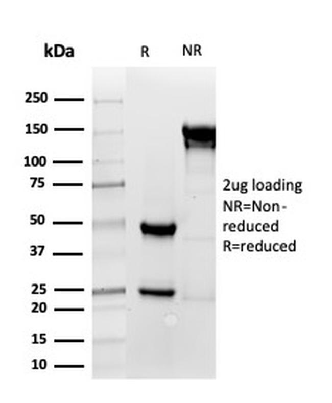 Thrombomodulin/CD141 Antibody in SDS-PAGE (SDS-PAGE)