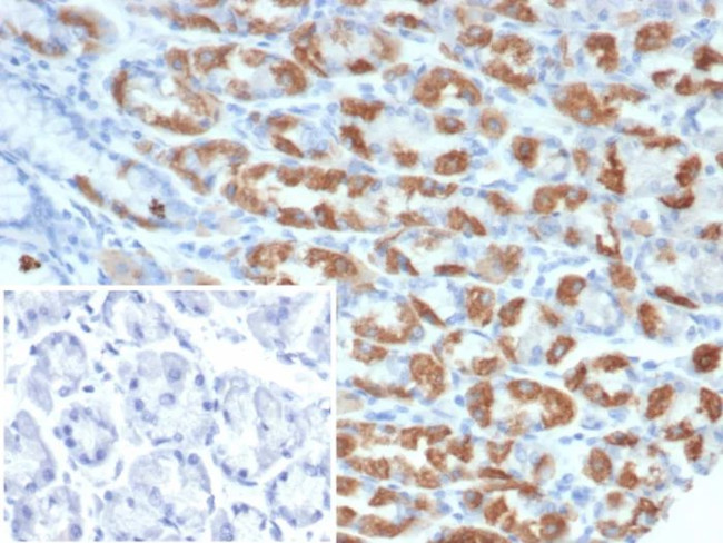 Thrombospondin-1/THBS1 Antibody in Immunohistochemistry (Paraffin) (IHC (P))