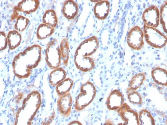 Thrombospondin-1/THBS1 Antibody in Immunohistochemistry (Paraffin) (IHC (P))