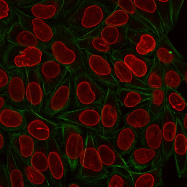 TIA1 (T-Cell-Restricted Intracellular Antigen-1) Antibody in Immunocytochemistry (ICC/IF)