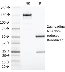 TIA1 (T-Cell-Restricted Intracellular Antigen-1) Antibody in SDS-PAGE (SDS-PAGE)