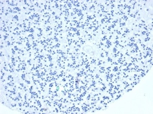 TIA1 (T-Cell-Restricted Intracellular Antigen-1) Antibody in Immunohistochemistry (Paraffin) (IHC (P))