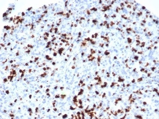 TIA1 (T-Cell-Restricted Intracellular Antigen-1) Antibody in Immunohistochemistry (Paraffin) (IHC (P))