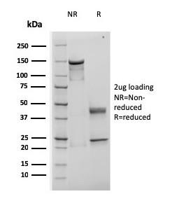 TIMP1 (Colorectal Cancer Biomarker/Marker of Lymph Node Metastasis) Antibody in SDS-PAGE (SDS-PAGE)