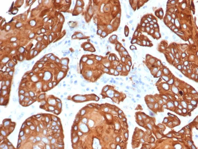 TIMP1 (Marker of Lymph Node Metastasis) Antibody in Immunohistochemistry (Paraffin) (IHC (P))