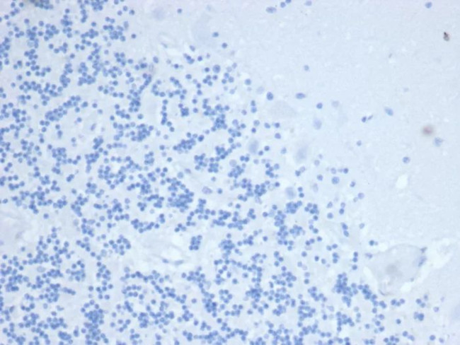 TIMP1 (Marker of Lymph Node Metastasis) Antibody in Immunohistochemistry (Paraffin) (IHC (P))